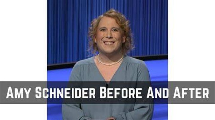 Amy Schneider Before Surgery All We Know