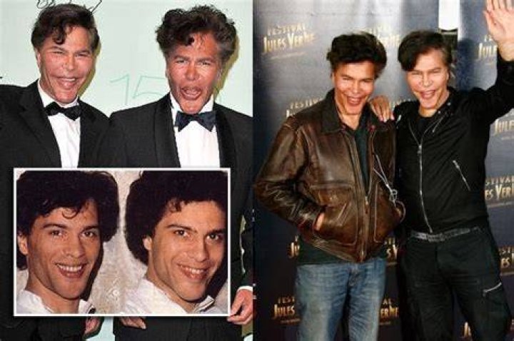Bogdanoff Twins Before And After Surgery Photos What Did Bogdanoff
