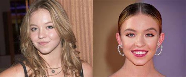 Did Sydney Sweeney Undergo Plastic Surgery? Truth Behind The Rumors