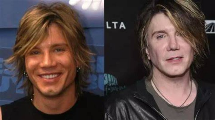 Goo Goo Dolls Frontman Plastic Surgery Before And After |