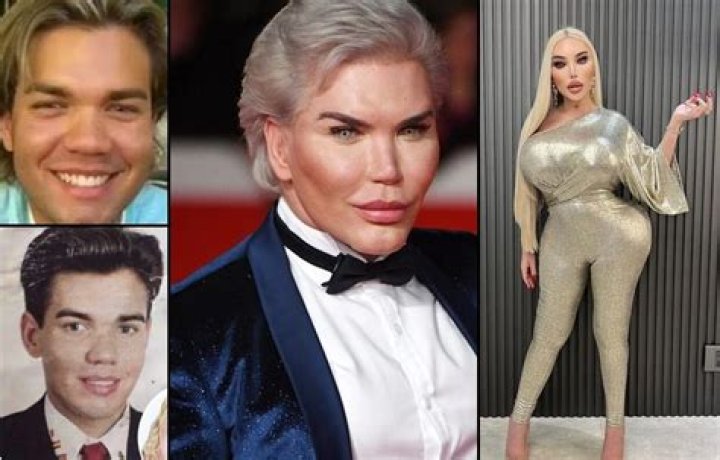 Who is Jessica Alves? Human Ken Doll talks life after surgery on This Morning Mon 13 July